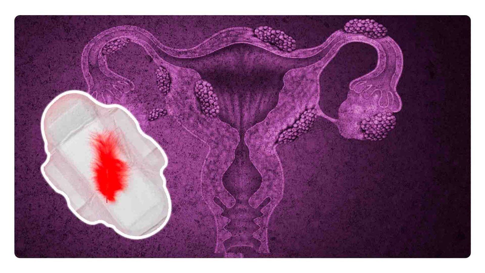 Aprueban Licencia menstrual en Nuevo León: Esto es el futuro