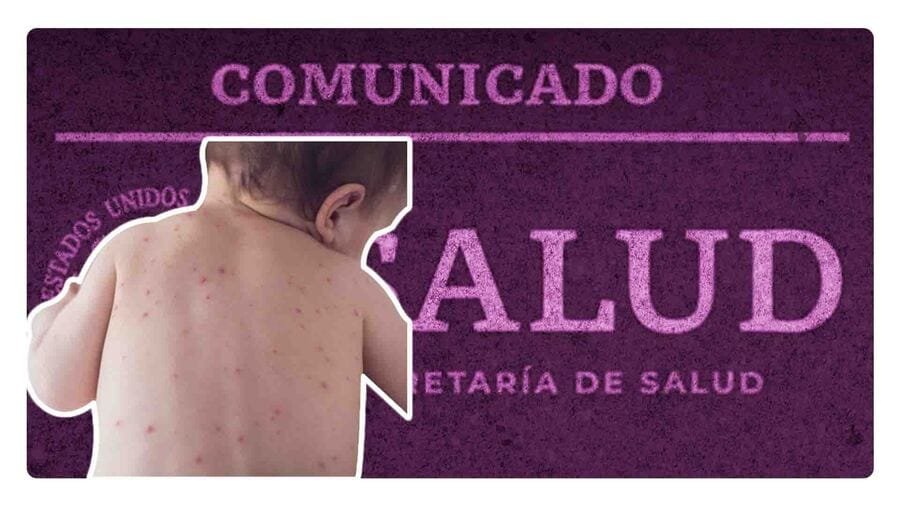 Llega un infante extranjero con sarampión al AICM