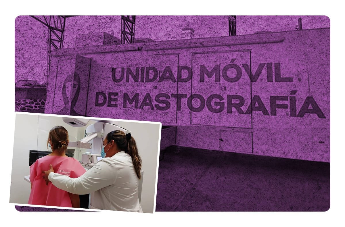 Jornada de mastografías: Prevención del cáncer de mama